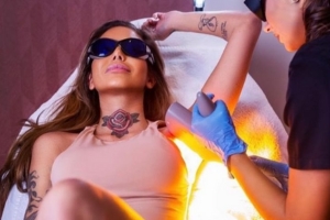 הסרת שיער ללא מאמץ