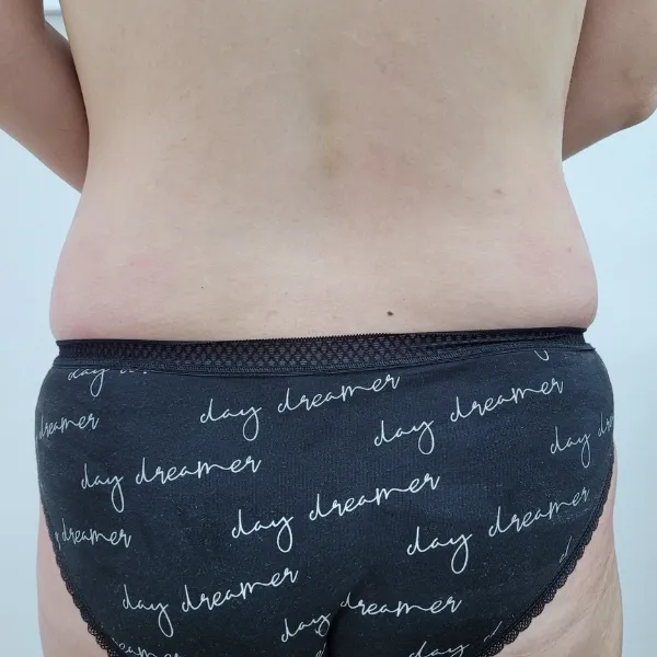 אחרי | צמצום היקפים