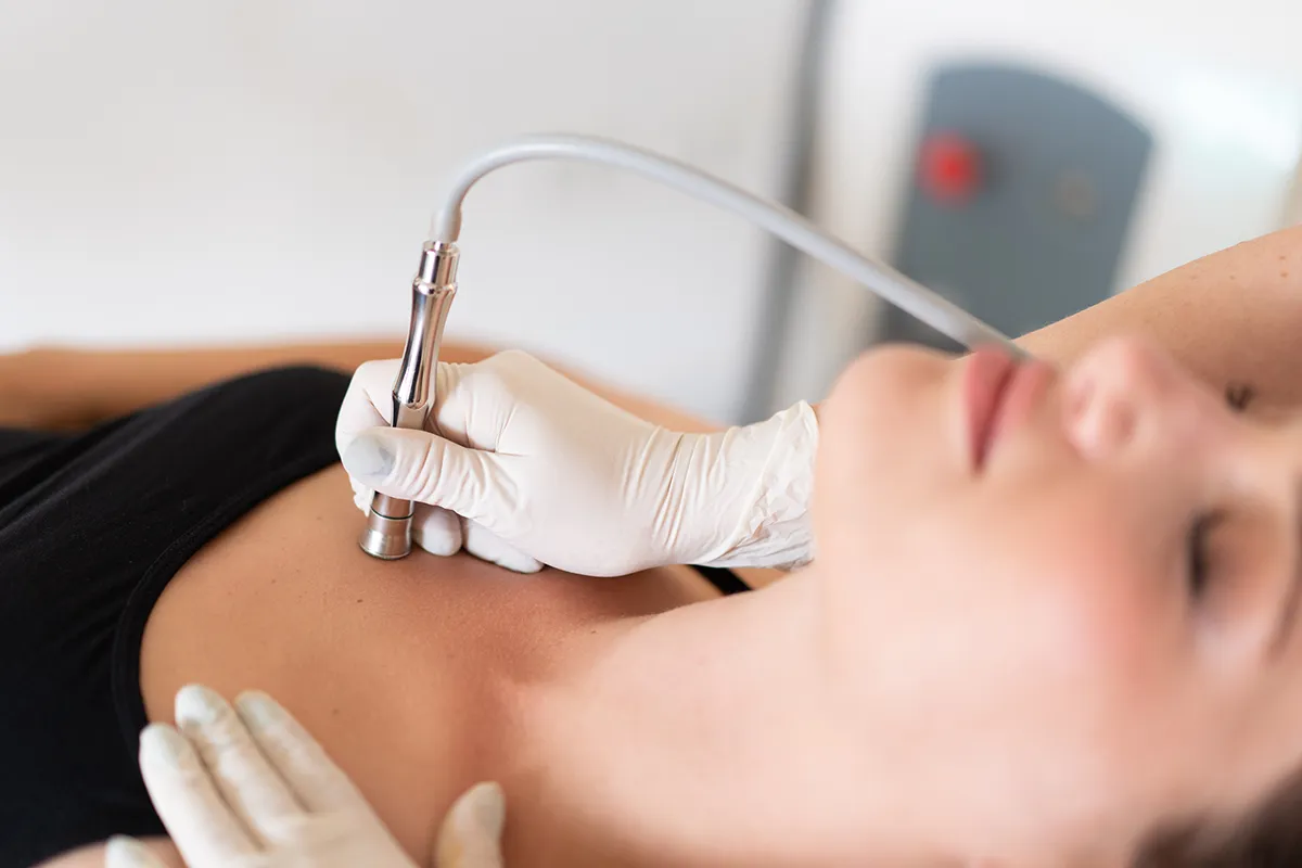 פילינג יהלום