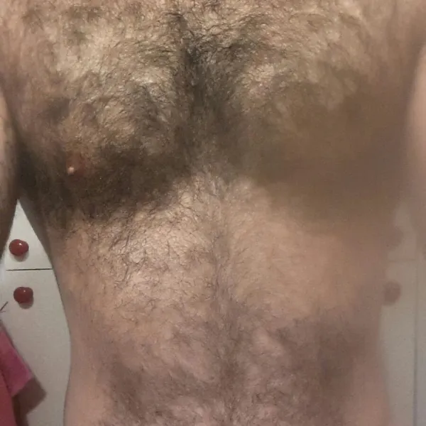 הסרת שיער | לפני