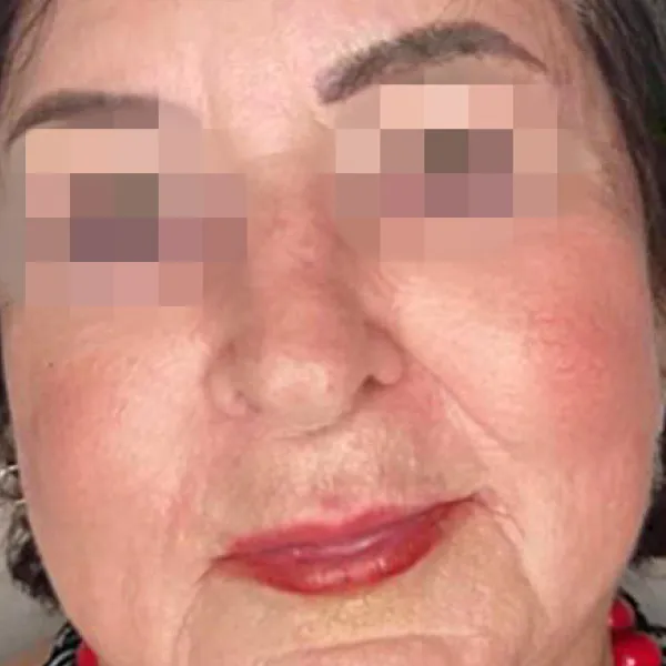 קופרוז | אחרי